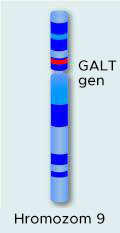 Galaktozemija - Tipovi galaktozemije